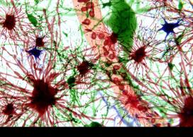 Star-shaped astrocytes